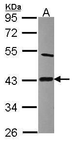CLP1 Rabbit Polyclonal Antibody