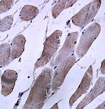 LMAN2L Rabbit Polyclonal Antibody
