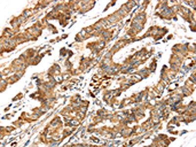 LONP1 Antibody