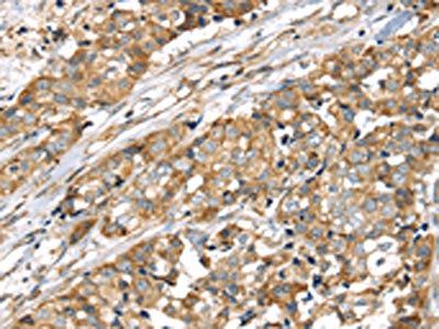 LONP1 Antibody