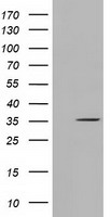 LOX Antibody