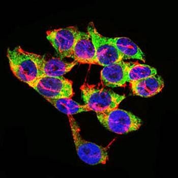 LPA Antibody