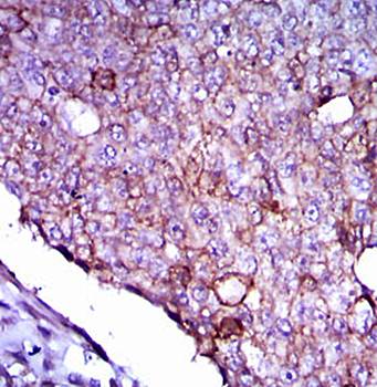 LPA Antibody