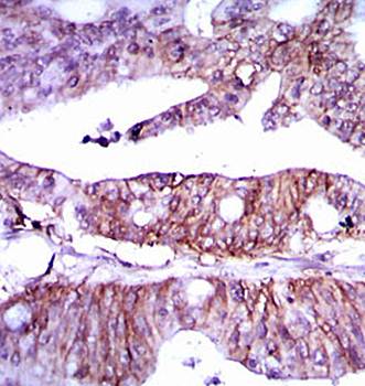 LPA Antibody
