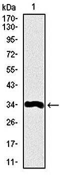 LPA Antibody