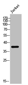LPAR1 Antibody