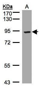 translocation associated membrane protein 1 Antibody