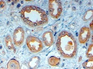 LRP6 Antibody