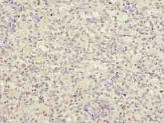 LRRC3B Antibody