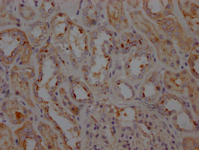 LRRK2 Antibody
