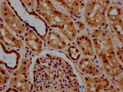 LSM8 Antibody