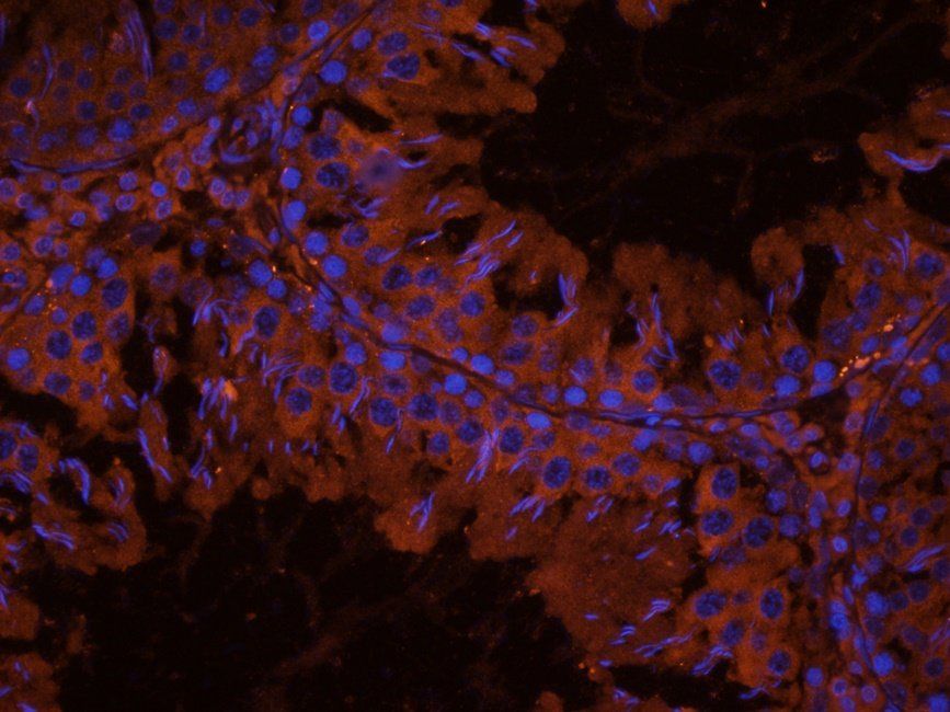 LTBP4 Rabbit Polyclonal Antibody