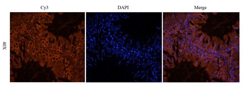 LTBP4 Rabbit Polyclonal Antibody