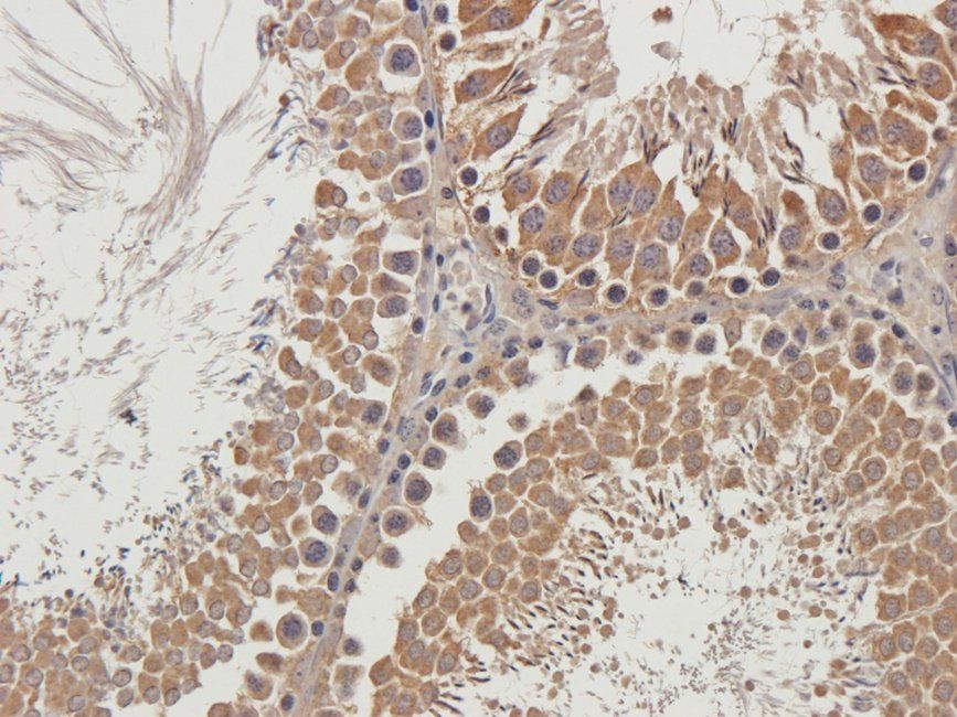LTBP4 Rabbit Polyclonal Antibody