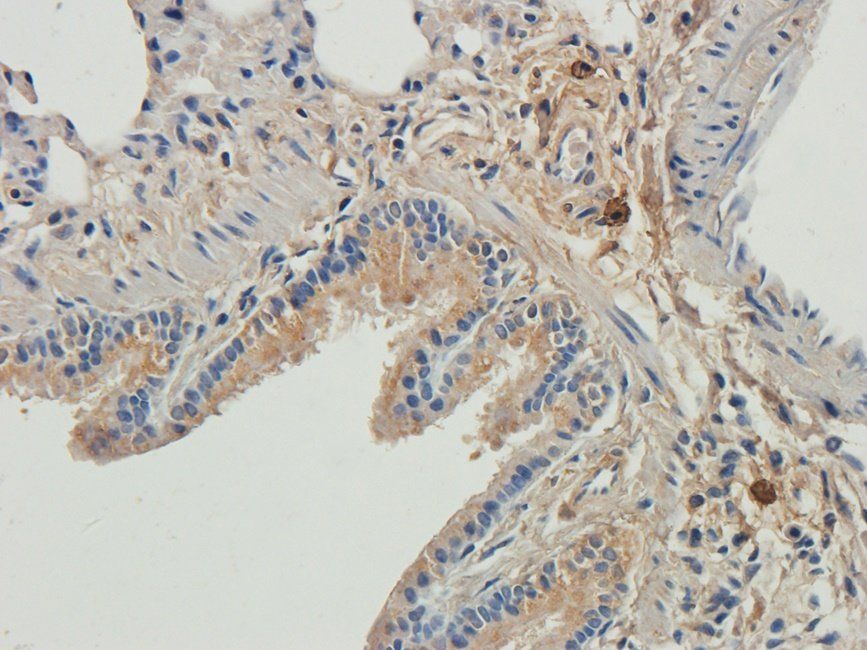 LTBP4 Rabbit Polyclonal Antibody