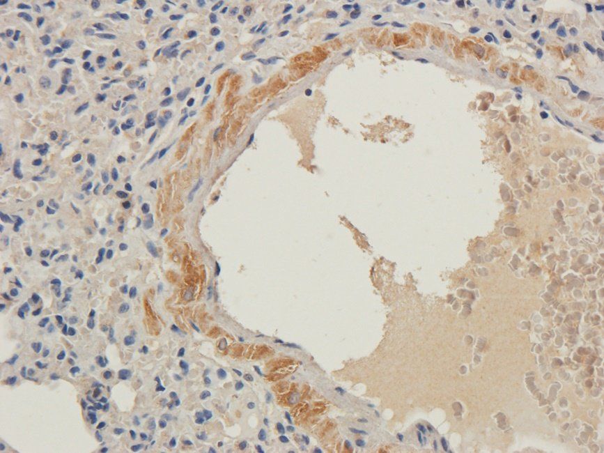 LTBP4 Rabbit Polyclonal Antibody
