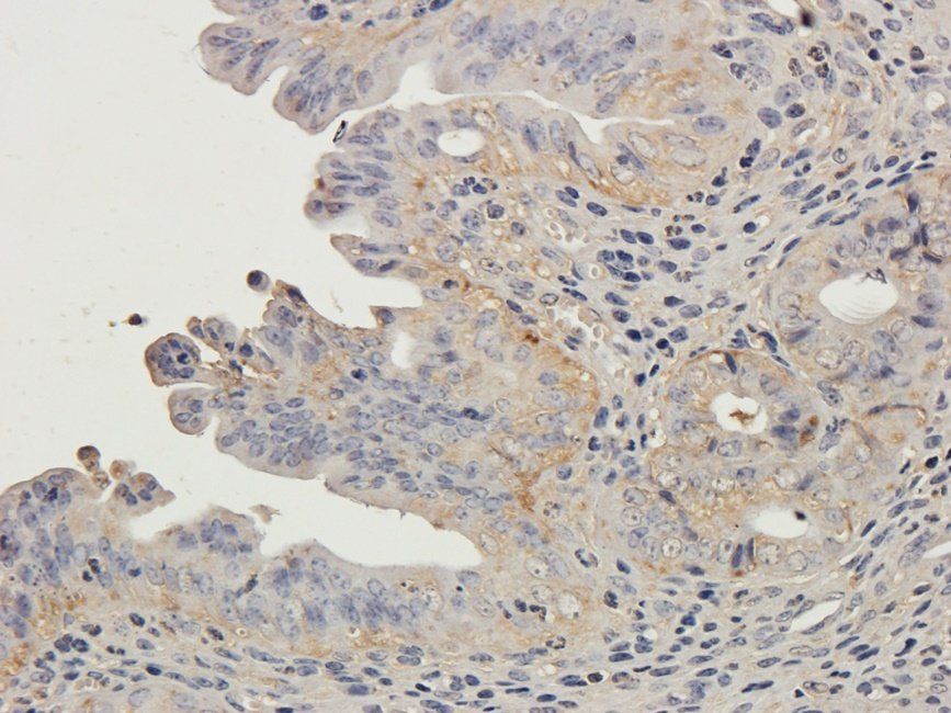 LTBP4 Rabbit Polyclonal Antibody