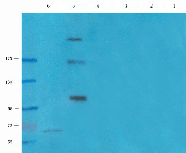 LTBP4 Rabbit Polyclonal Antibody