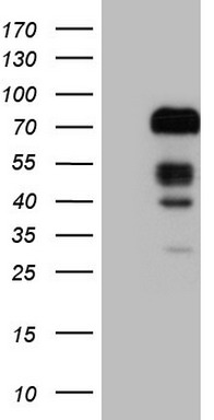 LTBR Antibody