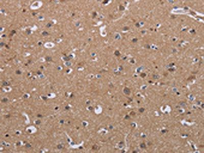 LUM Antibody