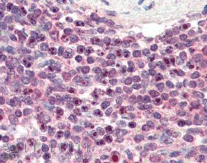 LXR beta/NR1H2 Antibody
