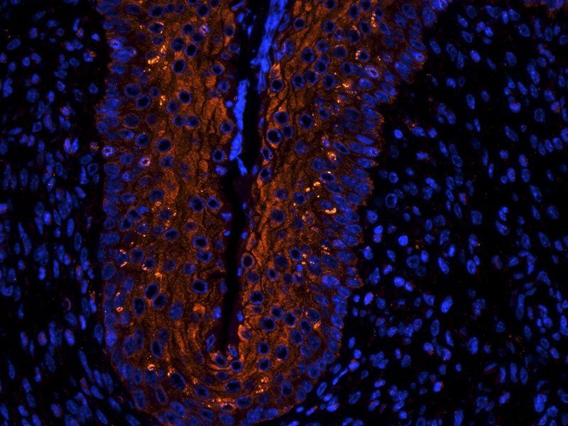 Ly-6G Rabbit Polyclonal Antibody