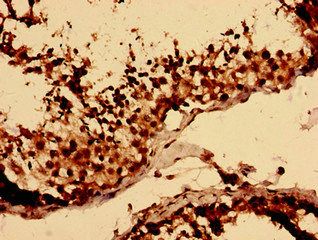 LY6H Antibody