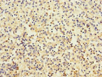 LY75 Antibody