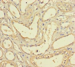BRCC3 Antibody