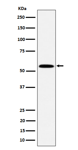 PNK/PNKP Rabbit Monoclonal Antibody