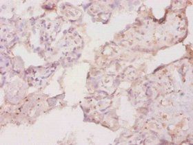 Csf1 Antibody