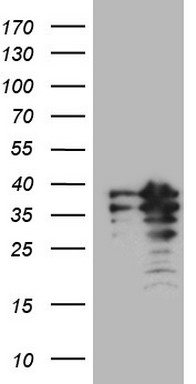 MAD2L1BP Antibody