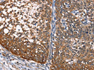 MAD2L1BP Antibody
