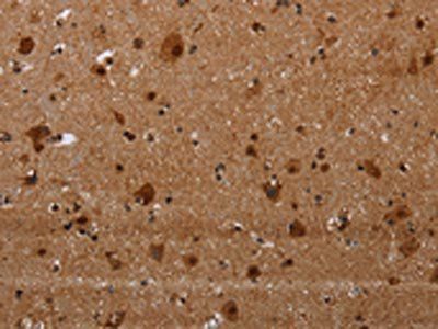 MAGEE1 Antibody