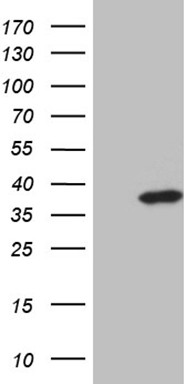 MALT1 Antibody