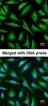 MALT1 Rabbit Polyclonal Antibody