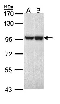 MALT1 Rabbit Polyclonal Antibody