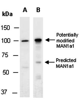 MAN1a1 (N1) Antibody, Rabbit Polyclonal