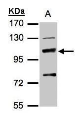 syntaxin binding protein 2 Antibody