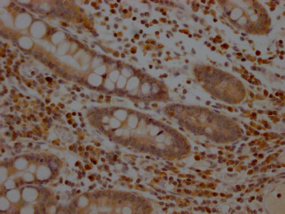 MAP2K1 Antibody