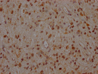 MAP2K1 Antibody