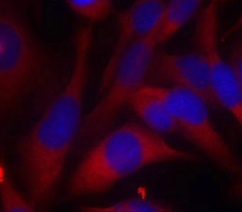 MAP2K6 Antibody