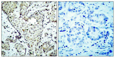 MAP2K6 Antibody