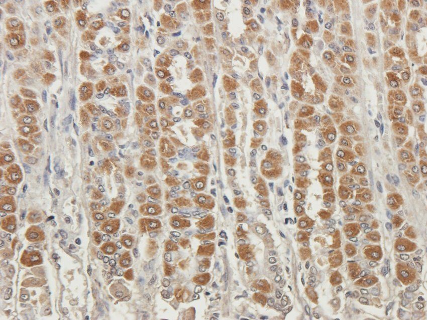 MAP2K7 Rabbit Polyclonal Antibody