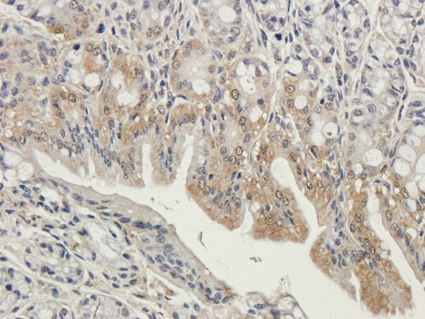MAP2K7 Rabbit Polyclonal Antibody