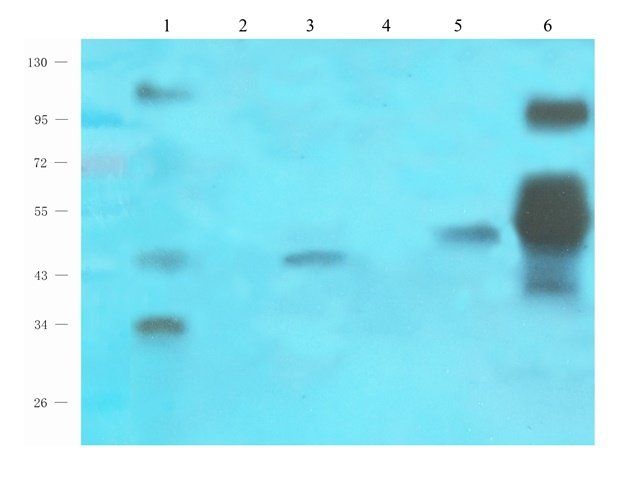 MAP2K7 Rabbit Polyclonal Antibody