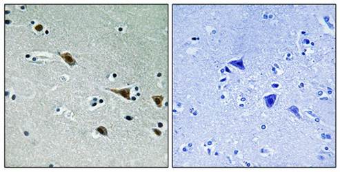 MAP2K7 (Phospho-Ser271) Antibody