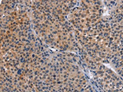 MAP3K13 Antibody
