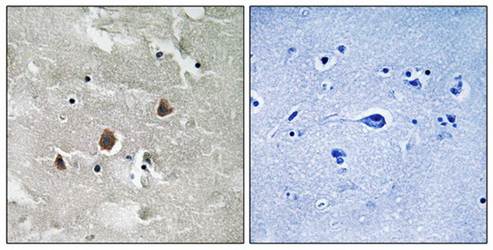 MAP3K1 (Phospho-Thr1402) Antibody