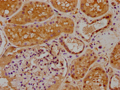 MAP3K2 Antibody